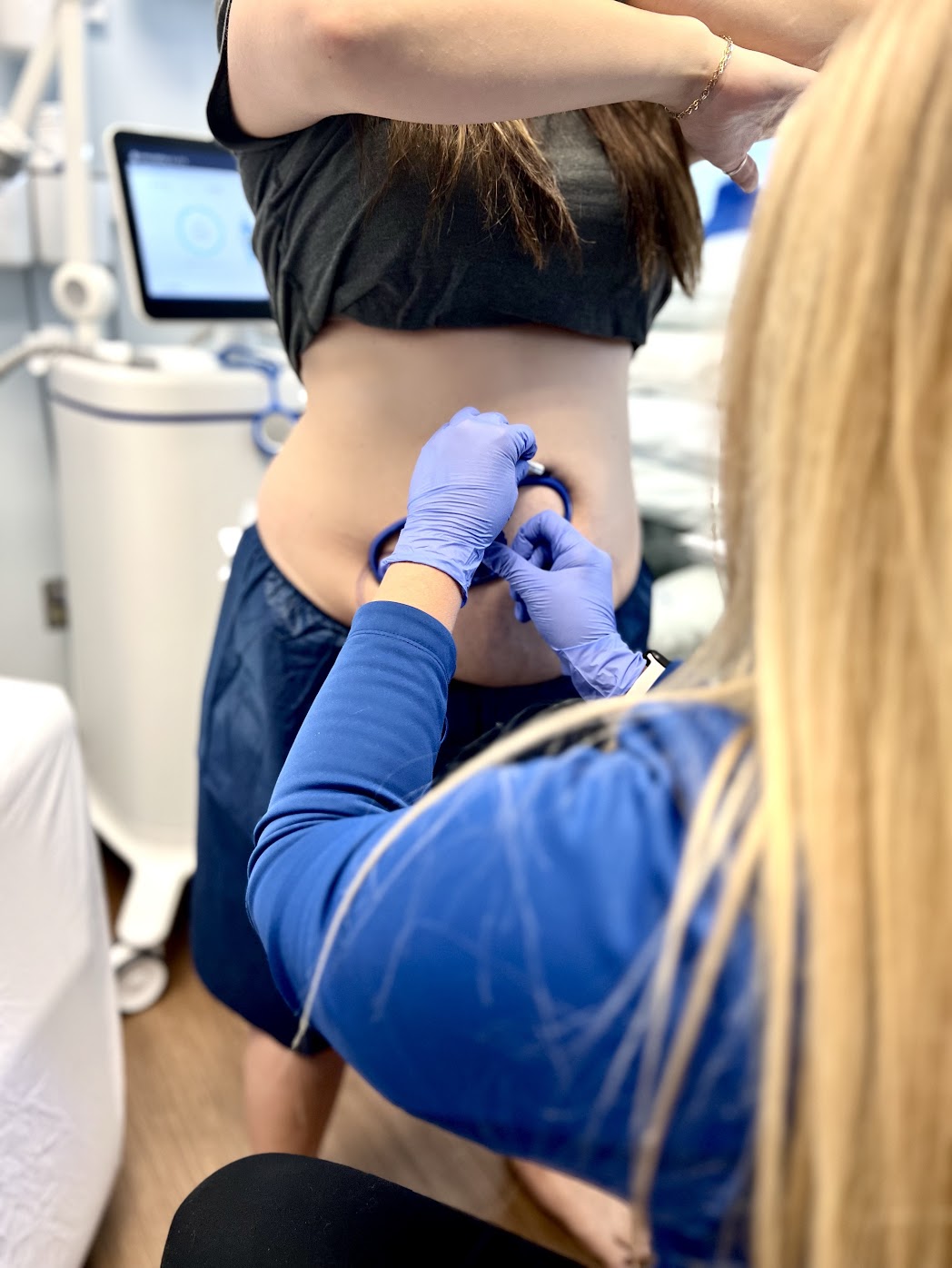 coolsculpting 6 CoolSculpting in St. Louis, MO